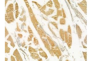 ABIN6258751 and ABIN6274763 at 1/100 staining human tongue carcinoma by IHC-P. (AZI1 anticorps  (C-Term))