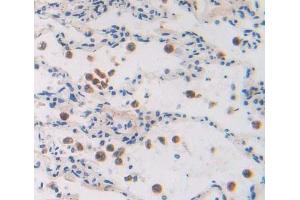 Used in DAB staining on fromalin fixed paraffin- embedded lung tissue (GTF2A2 anticorps  (AA 1-109))