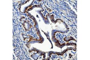 IHC analysis of EEF2 using anti-EEF2 antibody (ABIN7599561). (EEF2 anticorps  (AA 1-858))