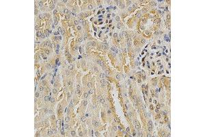 Immunohistochemistry of paraffin-embedded mouse kidney using HDAC6 antibody at dilution of 1:200 (x400 lens)
