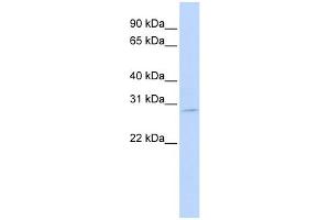 WB Suggested Anti-EXOSC7 Antibody Titration:  0. (EXOSC7 anticorps  (N-Term))