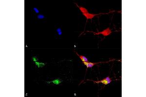 Immunocytochemistry/Immunofluorescence analysis using Mouse Anti-TrpV3 Monoclonal Antibody, Clone N15/4 (ABIN2485354).