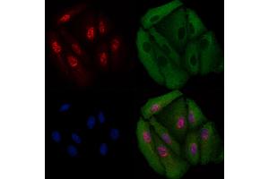 ABIN6258847 and ABIN6275709 staining  cells by IF/ICC. (RAD23B anticorps  (N-Term))