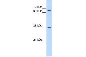 WB Suggested Anti-PPP2R3B Antibody Titration:  0. (PPP2R3B anticorps  (C-Term))