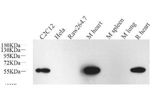 Western Blot analysis of various samples using Desmin Monoclonal Antibody at dilution of 1:1000. (Desmin anticorps)