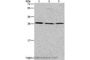Western blot analysis of Human fetal liver tissue, 293T and 231 cell, using TP53INP1 Polyclonal Antibody at dilution of 1:200 (TP53INP1 anticorps)