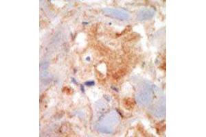 Image no. 2 for anti-Mast/stem Cell Growth Factor Receptor (KIT) (N-Term) antibody (ABIN359890) (KIT anticorps  (N-Term))