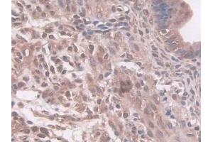 DAB staining on IHC-P; Samples: Mouse Uterus Tissue (NAT1 anticorps  (AA 9-254))