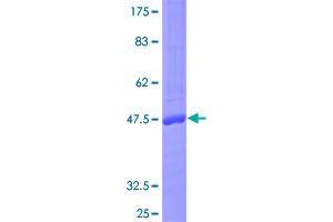 Image no. 1 for Interleukin 17F (IL17F) (AA 1-163) protein (GST tag) (ABIN1307711)