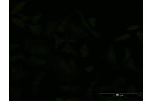 Immunofluorescence of monoclonal antibody to USP9X on HeLa cell. (USP9X anticorps  (AA 1-90))