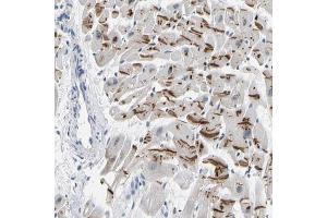 Immunohistochemical staining (Formalin-fixed paraffin-embedded sections) of human heart muscle with PKP2 polyclonal antibody  shows strong cytoplasmic positivity in myocytes. (Plakophilin 2 anticorps  (AA 72-194))