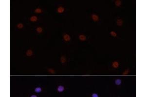 Immunofluorescence analysis of C6 cells using DNMT3B Polyclonal Antibody at dilution of 1:100. (DNMT3B anticorps)
