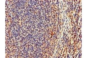 Immunohistochemistry of paraffin-embedded human lymph node tissue using ABIN7165180 at dilution of 1:100 (CASC1 anticorps  (AA 1-300))