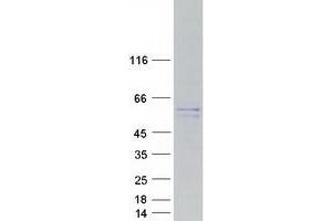 Validation with Western Blot