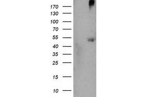 Western Blotting (WB) image for anti-Sedoheptulokinase (SHPK) antibody (ABIN1500922)