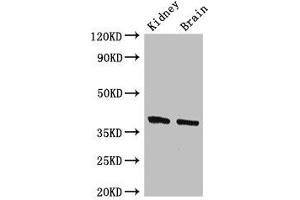 Western Blot Positive WB detected in: Mouse kidney tissue, Mouse brain tissue All lanes: FOXE1 antibody at 2. (FOXE1 anticorps  (AA 184-365))