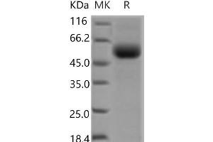Western Blotting (WB) image for Transforming Growth Factor, beta Receptor II (70/80kDa) (TGFBR2) protein (Fc Tag) (ABIN7321210)