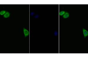 Detection of IL11Ra in Human Hela cell using Polyclonal Antibody to Interleukin 11 Receptor Alpha (IL11Ra) (IL11RA anticorps  (AA 194-329))