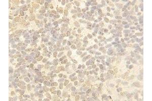 IHC-P: Cullin 4B antibody testing of Zebrafish Body tissue (Cullin 4B anticorps  (C-Term))