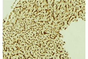 ABIN6274022 at 1/100 staining Mouse liver tissue by IHC-P.