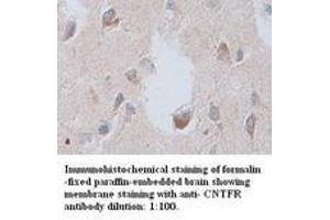 Image no. 1 for anti-Ciliary Neurotrophic Factor Receptor (CNTFR) antibody (ABIN791093) (CNTF Receptor alpha anticorps)