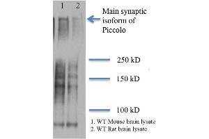 Western Blot analysis of Rat and mouse brain lysates showing detection of Piccolo protein using Mouse Anti-Piccolo Monoclonal Antibody, Clone 6H9-B6 (ABIN863104 and ABIN863105). (Piccolo anticorps)