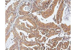 IHC analysis of CDK5 using anti-CDK5 antibody (ABIN6719393). (CDK5 anticorps  (AA 1-226))