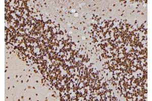 ABIN6257255 and ABIN6274428 at 1/100 staining Rat brain tissue by IHC-P. (HIPK4 anticorps  (C-Term))