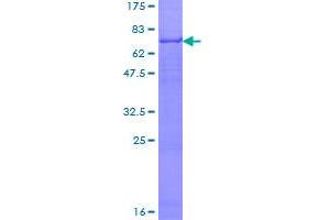 Image no. 1 for Glutaryl-CoA Dehydrogenase (GCDH) (AA 1-438) protein (GST tag) (ABIN1354902)