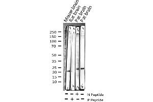 Western blot analysis of Phospho-CPI17 alpha (Thr38) expression in various lysates