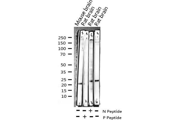 CPI-17 anticorps  (pThr38)