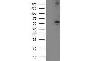 Western Blotting (WB) image for anti-Protein Phosphatase, Mg2+/Mn2+ Dependent, 1B (PPM1B) antibody (ABIN1500375) (PPM1B anticorps)