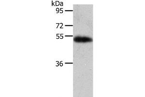 Western Blot analysis of Human liver cancer tissue using AGT Polyclonal Antibody at dilution of 1:700 (AGT anticorps)