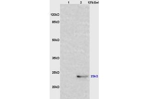 L1 mouse lung lysates L2 protein provided by the end user lysates probed with Anti IL-6 Polyclonal Antibody, Unconjugated (ABIN728083) at 1:200 overnight at 4 °C.