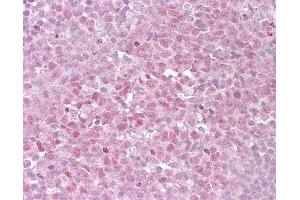 Anti-TERF2 antibody IHC of human tonsil.