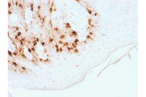 Formalin-fixed, paraffin-embedded human Skin stained with MART-1 Rabbit Recombinant Monoclonal Antibody (MLANA/1761R) (HRP-DAB).
