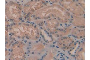 DAB staining on IHC-P; Samples: Human Kidney Tissue