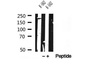 Western blot analysis of extracts of K-562 cells, using RB1CC1 antibody. (FIP200 anticorps)