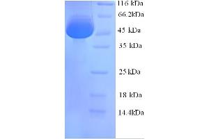 SDS-PAGE (SDS) image for Calreticulin (CALR) (AA 18-416) protein (His tag) (ABIN5713308)