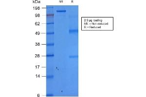 SDS-PAGE Analysis PurifiedEpCAM Recombinant Mouse Monoclonal Antibody (rEGP40/1372).