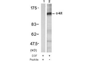 Image no. 1 for anti-Mast/stem Cell Growth Factor Receptor (KIT) (Tyr721) antibody (ABIN319333) (KIT anticorps  (Tyr721))