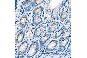 Immunohistochemistry analysis of paraffin embedded rat colon using CYPIW1 (ABIN7073674) at dilution of 1: 500 (CYP2W1 anticorps)