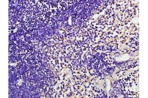 Paraformaldehyde-fixed, paraffin embedded mouse spleen tissue, Antigen retrieval by boiling in sodium citrate buffer(pH6) for 15min, Block endogenous peroxidase by 3% hydrogen peroxide for 30 minutes, Blocking buffer (normal goat serum) at 37°C for 20min, Antibody incubation with CD19 (Tyr531) Polyclonal Antibody, Unconjugated  at 1:500 overnight at 4°C, followed by a conjugated secondary and DAB staining