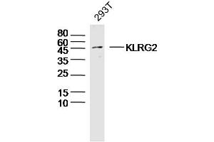 293T lysates probed with KLRG2 Polyclonal Antibody, Unconjugated  at 1:300 dilution and 4˚C overnight incubation. (KLRG2 anticorps  (AA 101-200))