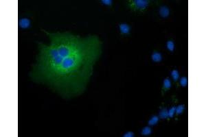 Anti-TCP11L2 mouse monoclonal antibody (ABIN2453717) immunofluorescent staining of COS7 cells transiently transfected by pCMV6-ENTRY TCP11L2 (RC207129). (TCP11L2 anticorps)