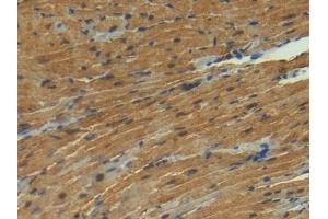 Detection of S100 in Mouse Heart Tissue using Polyclonal Antibody to S100 Calcium Binding Protein (S100) (S100 Protein (S100) (AA 2-94) anticorps)