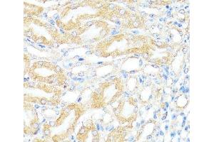 Immunohistochemistry of paraffin-embedded Mouse kidney using BAX Polyclonal Antibody at dilution of 1:100 (40x lens). (BAX anticorps)