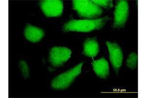 Immunofluorescence of monoclonal antibody to MAP2K5 on HeLa cell. (MAP2K5 anticorps  (AA 1-120))