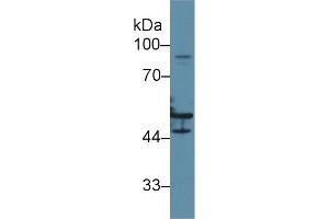 Mouse Capture antibody from the kit in WB with Positive Control: Human hela cell lysate. (KRT16 Kit ELISA)