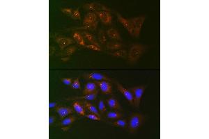 Immunofluorescence analysis of U-2 OS cells using γ-Tubulin Rabbit mAb (ABIN7271052) at dilution of 1:100 (40x lens).